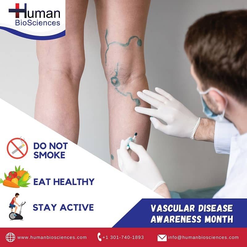 Prevent Ulcers in the Venous Legs Prevent Ulcers in the Venous Legs
